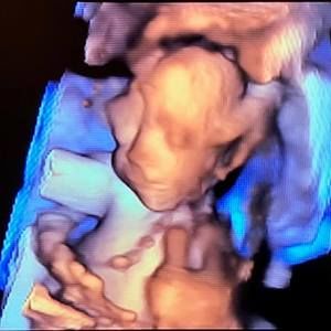 Meet your Posher, Collin